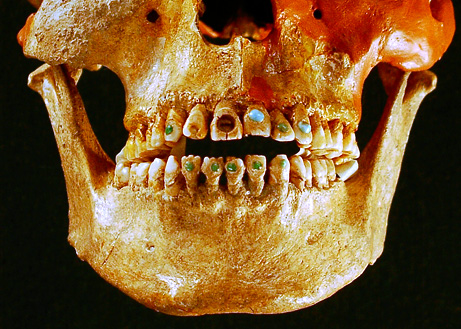 jeweled teeth picture big Top 10 Nat Geo Discoveries of 2009