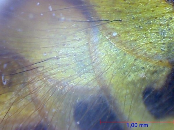 Wasp under the microscope - Side of the abdomen